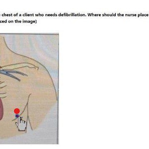 May include: Anatomical illustration of a human torso with a heart and other internal organs visible. The image shows the placement of a defibrillator paddle on the chest. Text at the top asks where the second paddle should be placed.