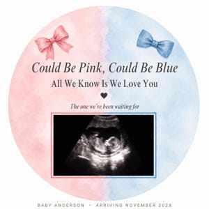 Pink & Blue Pregnancy Announcement Ultrasound Template: Gender Neutral Baby Reveal Download (Digital Download)