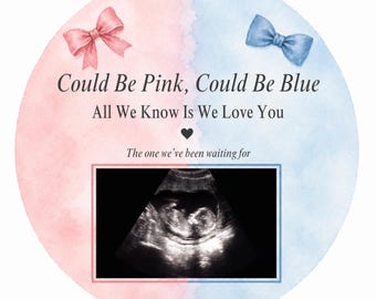 Ultraschallvorlage für die Schwangerschaftsankündigung in Rosa und Blau: Geschlechtsneutrale Baby-Enthüllung (Digitaler Download)
