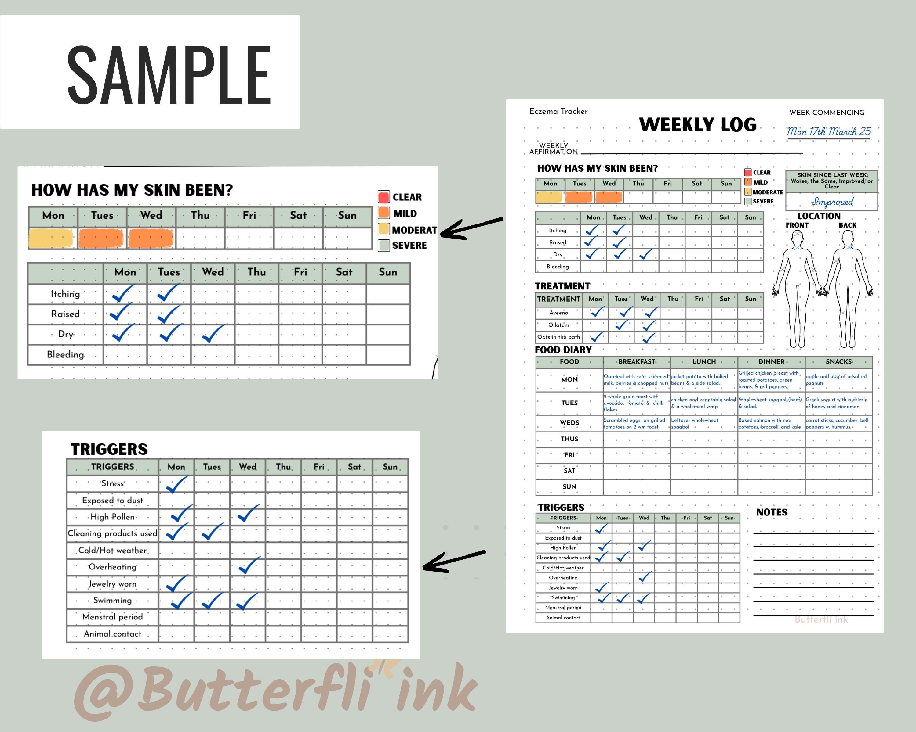 Weekly Trigger Log Weekly Eczema Tracker for Kids | Printable Skin Diary, Flare-up Log ...
