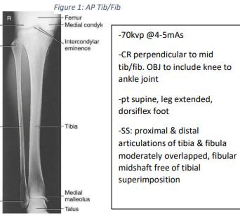 Tib/fib, Knee and Patella X-ray Positioning Cheat Sheet - Etsy