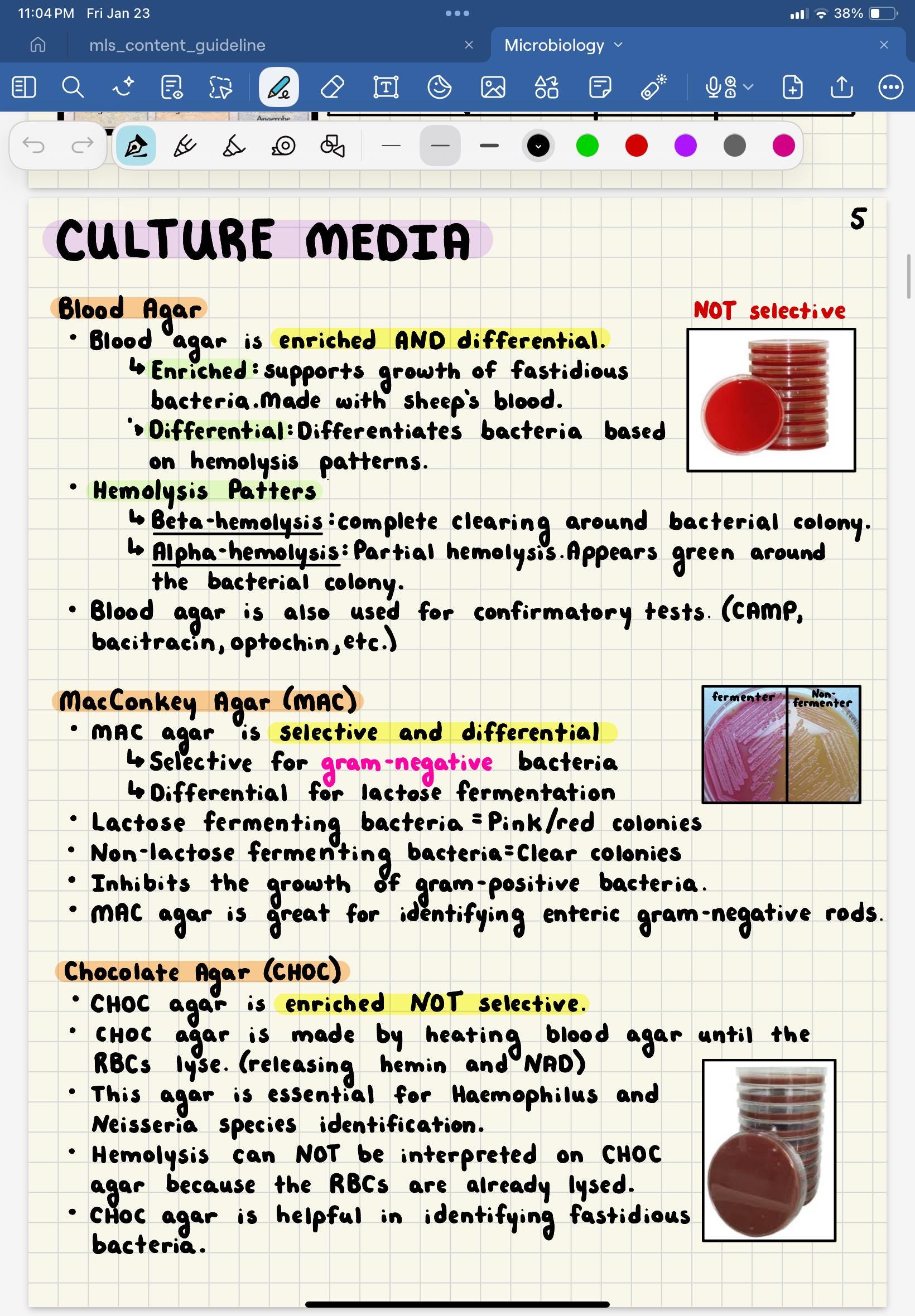 Mls Study Guide MICROBIOLOGY ASCP Notes | 50 Page Handwritten MLS Study Guide | High ...