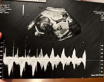 Individuelles 3D-Ultraschallbild | Personalisierte Baby-Sonogramm-Anzeige | Schwangerschaft-Andenken | Einzigartiges Babypartygeschenk