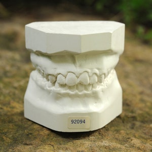Vintage Dental Mold plaster cast / dentist plaster teeth mold set