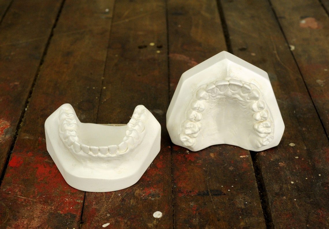 Vintage Dental Mold Plaster Cast / Dentist Plaster Teeth Mold Etsy