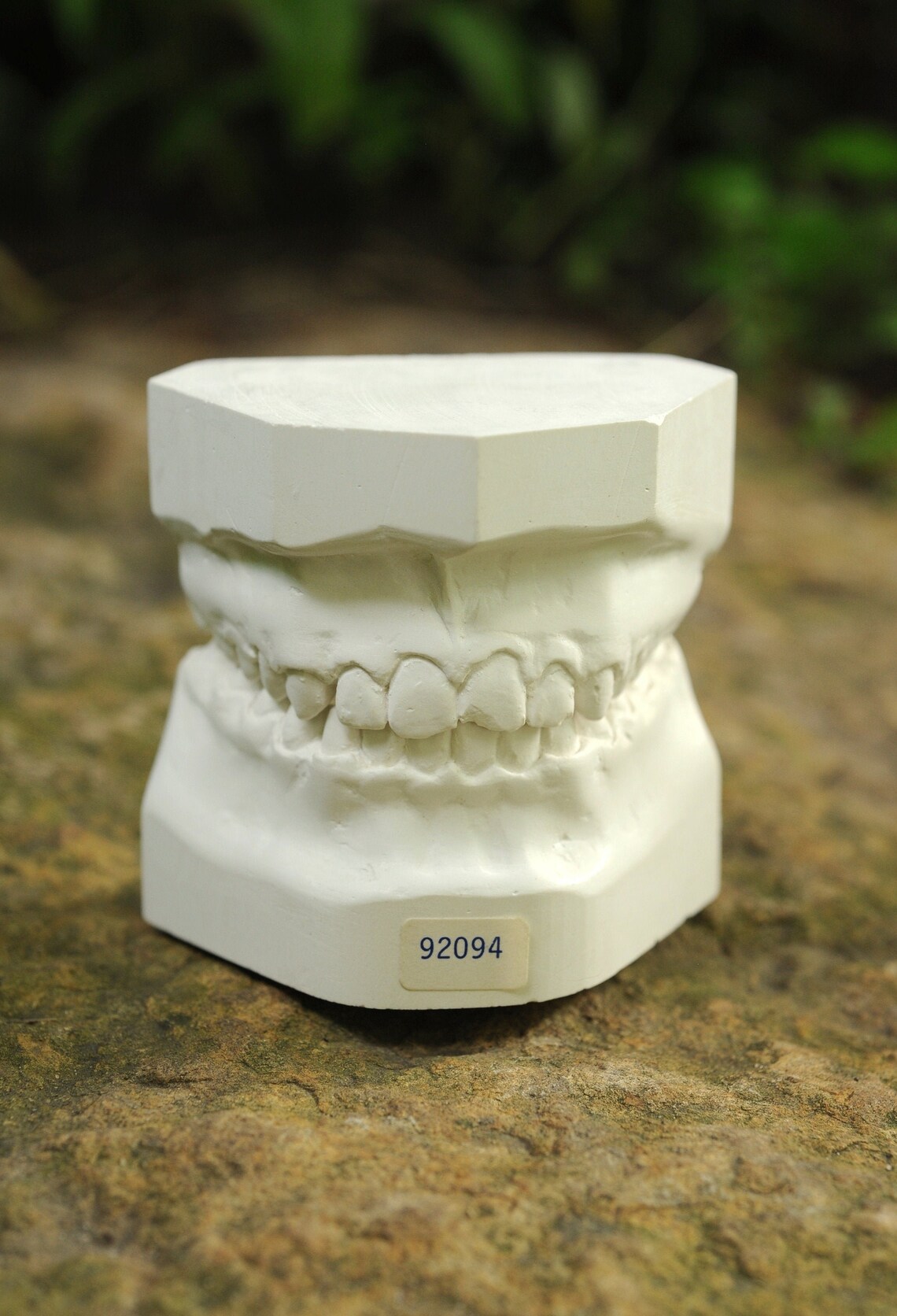 Vintage Dental Mold Plaster Cast / Dentist Plaster Teeth Mold Etsy