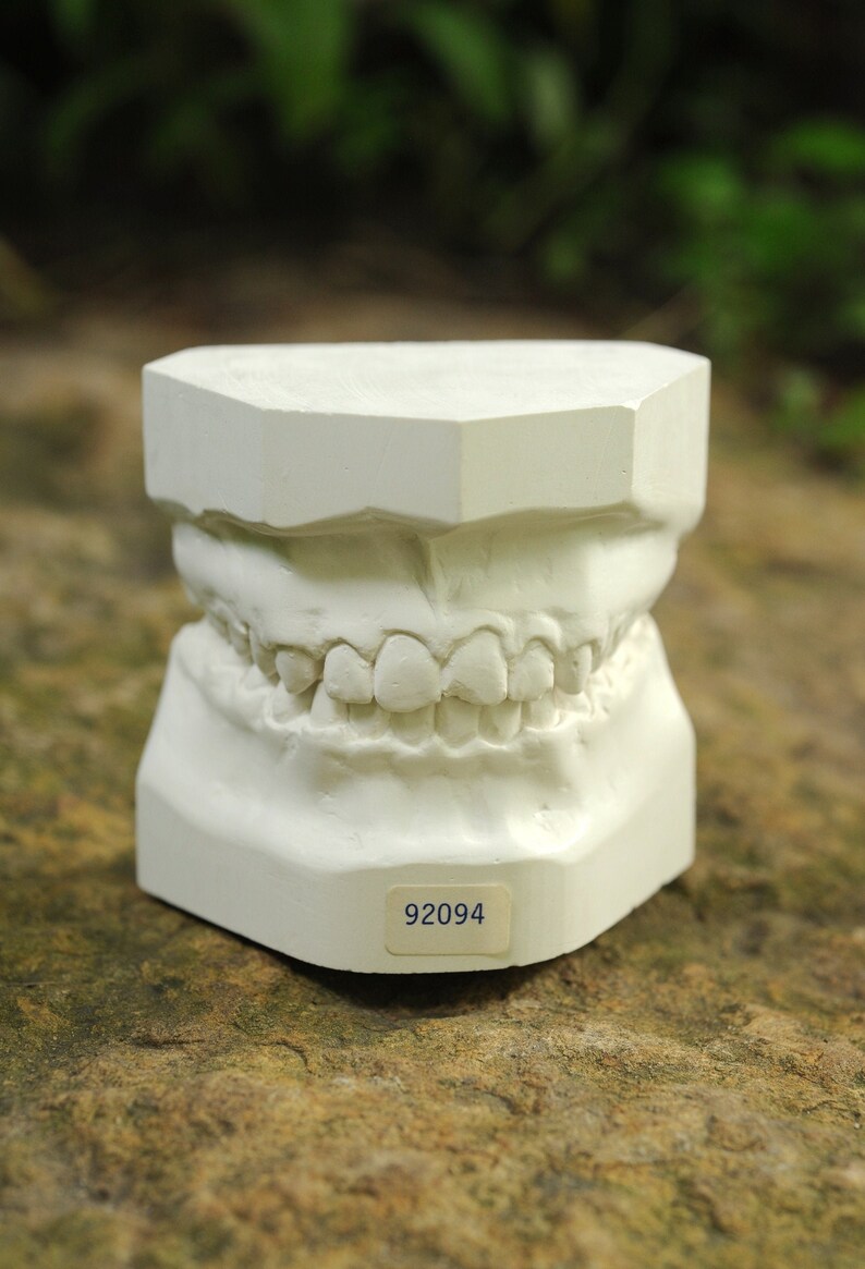 Vintage Dental Mold Plaster Cast / Dentist Plaster Teeth Mold Etsy