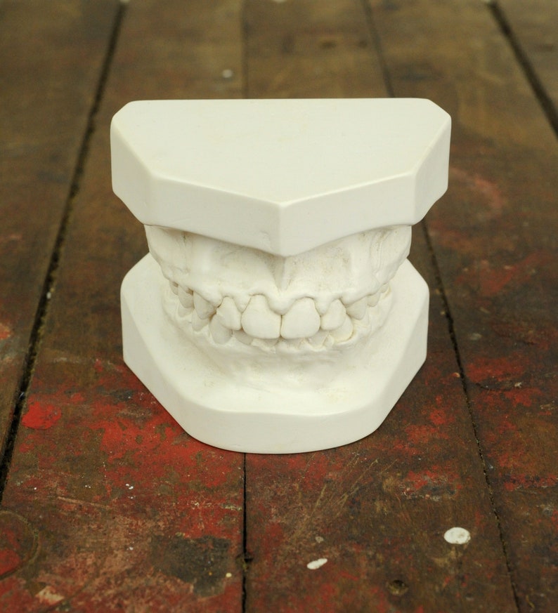 Vintage Dental Mold Plaster Cast / Dentist Plaster Teeth Mold Etsy