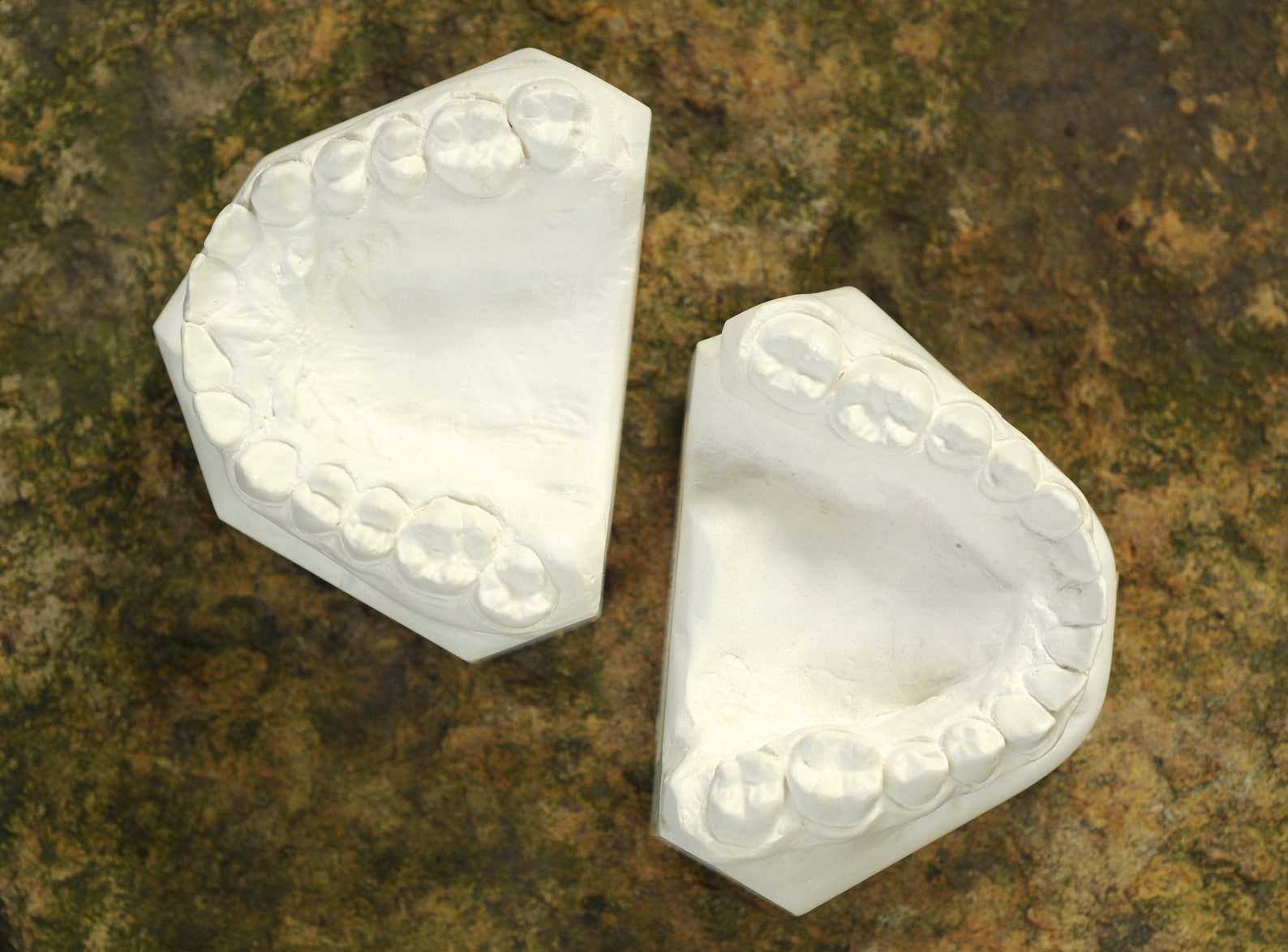 Vintage Dental Mold Plaster Cast / Dentist Plaster Teeth Mold Etsy