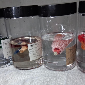 May include: Four clear plastic jars with black lids, each filled with liquid and a unique crocheted object. The jars feature white or tan labels with handwritten text. The objects inside include a green shape, a small tan piece, a pink textured form, and a red and orange ruffled item.