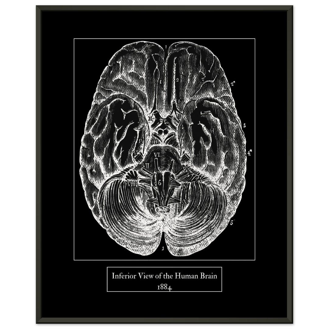 Vintage Brain Anatomy Print | Black and White Inverted Museum-quality ...