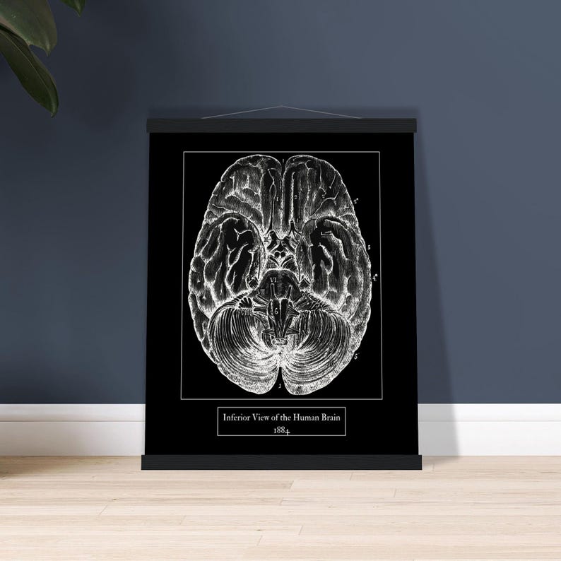 Vintage Brain Anatomy Print | Black and White Inverted Museum-quality ...
