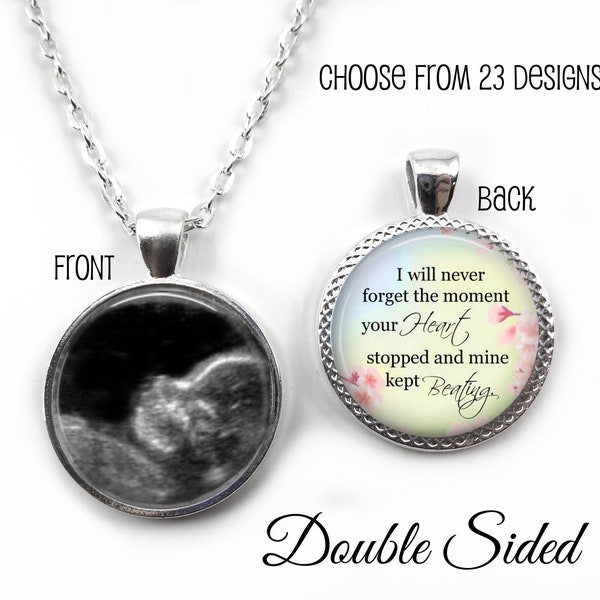 Ultrasound Memorial Necklace - Miscarriage Keepsake Jewelry - Double Sided Custom Photo Sonogram Necklace Personalized Loss of Baby Pendant