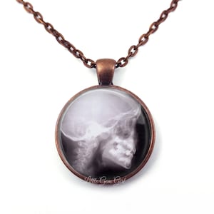 Skeleton XRay Necklace - Human Skull X Ray Pendant Jewelry - 4 Metal Finishes - Medical x ray Steampunk Gothic Doctor Nurse Necklace Charm