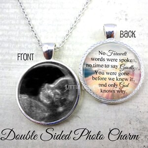miscarriage ultrasound keepsake