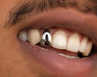 Puede incluir: Una sola funda dental de color plateado colocada en un colmillo superior. La superficie metálica es altamente reflectante, mostrando un acabado tipo espejo que captura el entorno en su exterior liso, pulido y curvado de la pieza.