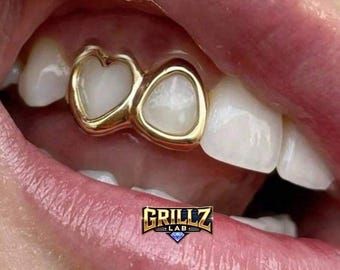 Parrillas dentales personalizadas con marco de doble corazón, hechas a mano en Londres.