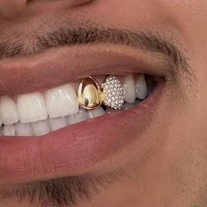 May include: Close-up of a person's smile, showing two gold teeth grills. One is solid gold, the other encrusted with small, sparkling crystals. The teeth are white, and the skin around the mouth is a light brown.