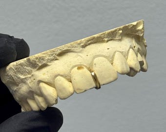 ¡Tapa para parrilla rellenable! ¡Dorada y plateada! ¡ENVÍO GRATIS!