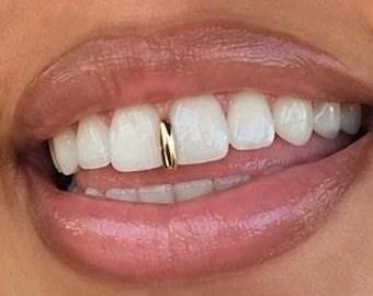 ¡Tapa para rellenar huecos de parrilla dental! ¡Oro, plata! ¡ENVÍO GRATIS!