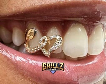 Parrilla dental personalizada con diseño de corazón en espiral, hecha a mano en Londres.