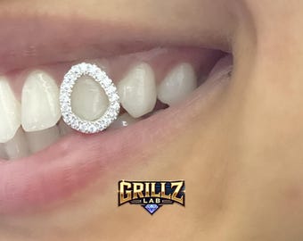 ¡Tapa de rejilla para ventana de diamante! ¡ENVÍO GRATIS!