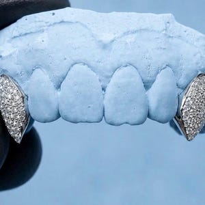 May include: A pair of silver-toned canine tooth caps, or grills, featuring a pavé setting of small, clear, sparkling stones. These decorative dental covers are fitted onto a light blue dental mould representing the upper front teeth.