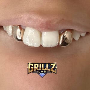 Griglie per denti personalizzate, fatte a mano in oro o argento, realizzate su misura