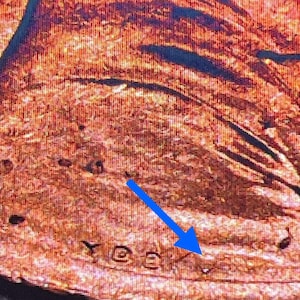 Extra V Error Lincoln Shield Cent - Choice BU - Rare Error Coin