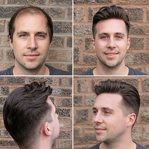 Op de afbeelding: Een vierpaneelafbeelding met een man met dunner wordend haar en vervolgens met een vol hoofd gestyled donkerbruin haar. De man draagt een grijs shirt en staat voor een bakstenen muur.