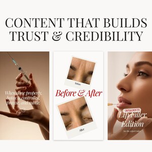 May include: An image with text that reads "CONTENT THAT BUILDS TRUST & CREDIBILITY." The image includes a hand holding a syringe, a "Before & After" photo, and a woman's face with text that reads "Lip Filler Edition."