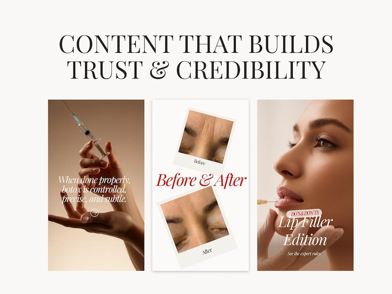 May include: An image with text that reads "CONTENT THAT BUILDS TRUST & CREDIBILITY." The image includes a hand holding a syringe, a "Before & After" photo, and a woman's face with text that reads "Lip Filler Edition."