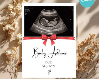 Faire-part de bébé minimaliste | Révélation par ultrasons (numérique)
