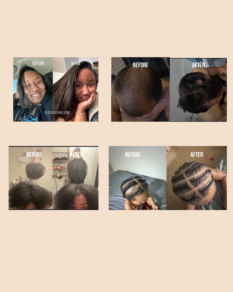 Analyzing Consumer Behavior in Hair Growth Serum Market