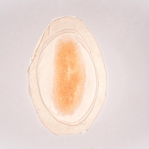 May include: An oval-shaped, translucent adhesive patch with a clear border and a textured, peach-colored center. The patch features a smooth, glossy finish and a distinct layered appearance, with a central oval area surrounded by a wider, transparent edge.
