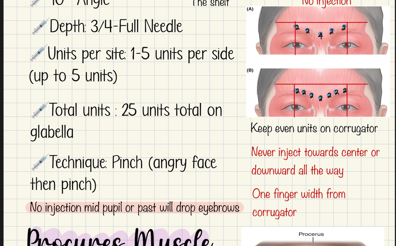 Botox 101 Injector Guide | Facial Mapping, Units, Needle Depth (digital ...