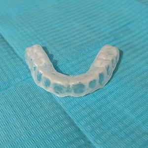 May include: A clear, U-shaped dental aligner tray made of smooth, transparent plastic. The aligner features moulded indentations that correspond to the shape of individual teeth, designed to fit over a dental arch for orthodontic alignment.