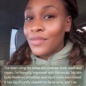 May include: A woman with dark skin and braided hair smiles, wearing a green hoodie. Text in the image mentions using Adoja skin cleanser, body wash, and cream, and the positive results.