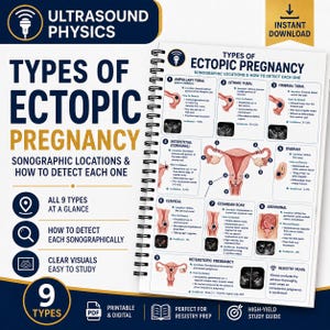 Ultrasound Physics Ectopic Pregnancy Sonographic | Types & Detection