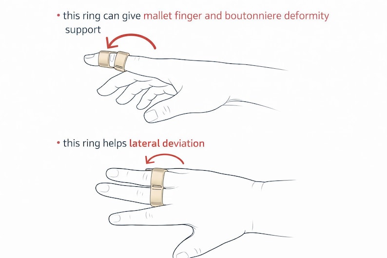 Ed's Hand Splints Sterling Silver Full Finger Splint Ring, Arthritis Support, EDS Brace ...
