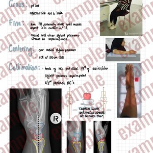 Puede incluir: Guía de estudio de anatomía con notas manuscritas y diagramas sobre un fondo de cuadrícula. Incluye imágenes de rayos X de una muñeca, dibujos anatómicos y texto que describe la muñeca lateral y los procedimientos médicos relacionados.