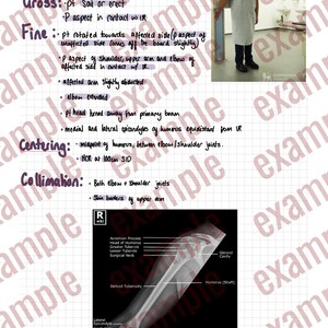 May include: An AP Humerus medical diagram with text detailing positioning and anatomical structures. Includes an X-ray image of the humerus bone and a person in a hospital gown. The text includes terms like 'centering' and 'collimation'.