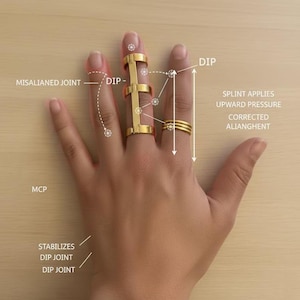 以下が含まれることがあります： 金色の指用スプリントと指輪をつけた手。スプリントは関節の配置を矯正するように設計されており、「DIP」と「MCP」のラベルが付いています。画像には「スプリントは上向きの圧力を加える」と「修正されたアライメント」を示すテキストも表示されています。