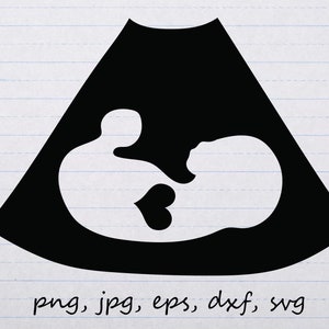 Échographie foetus avec coeur silhouette contour clipart graphique vectoriel Timbre numérique svg png jpg eps dxf cricut fichier de découpe