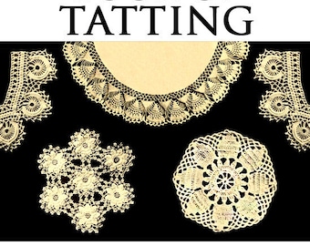 May include: A book titled "The Book of Tatting" with a cover featuring various tatting patterns, including edgings, medallions, and insertions. The book includes 63 patterns and is by Myrtle V. Rundall.