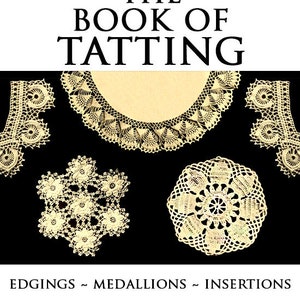 The ILLUSTRATED Book of TATTING ~ Edgings ~ Medallions ~ Insertions 63 Pattern Designs with Instructions 19 Pages Printable Instant Download