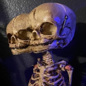 Two-Headed Conjoined Fetal Skeleton