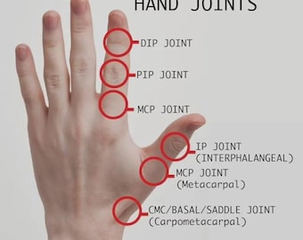 Arthritis Finger Splint For Bcnding Sideways Lateral Deviation Sterling Silver 925, Brass or Copper Ring For Ehlers Danols, EDS Rings