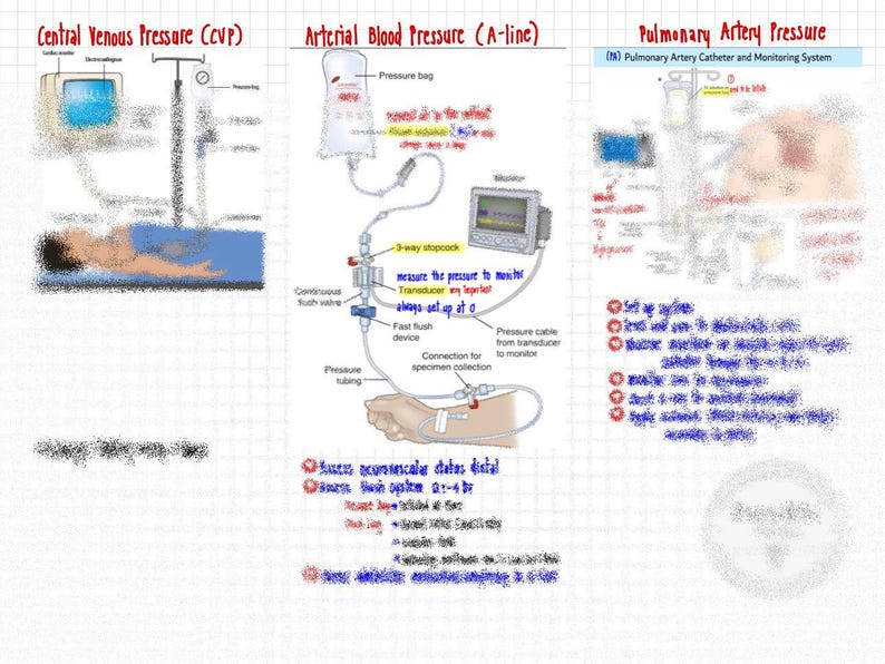 Hymodiamic Notes Hemodynamic Monitoring Nursing Notes | ICU Critical Care Study Guide ...