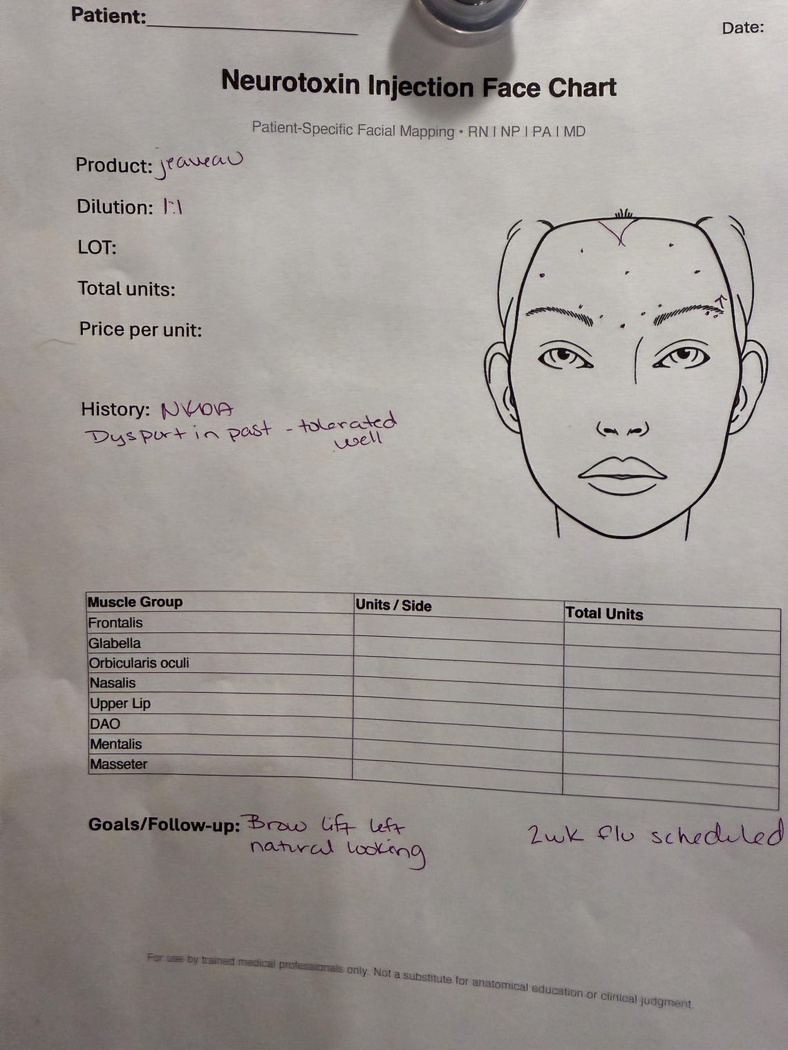 Neurotoxin Injection Face Chart | Patient Facial Mapping PDF | Botox ...